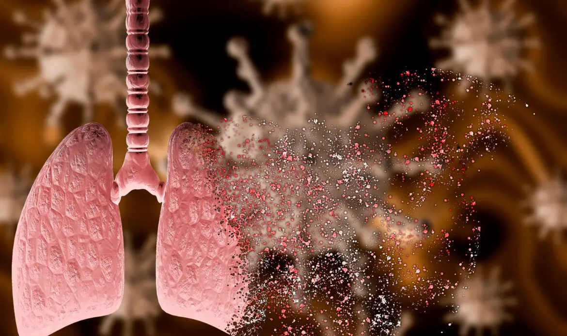 coronavirus attacking lung with severe pneumonia disintegrating it, leading to death