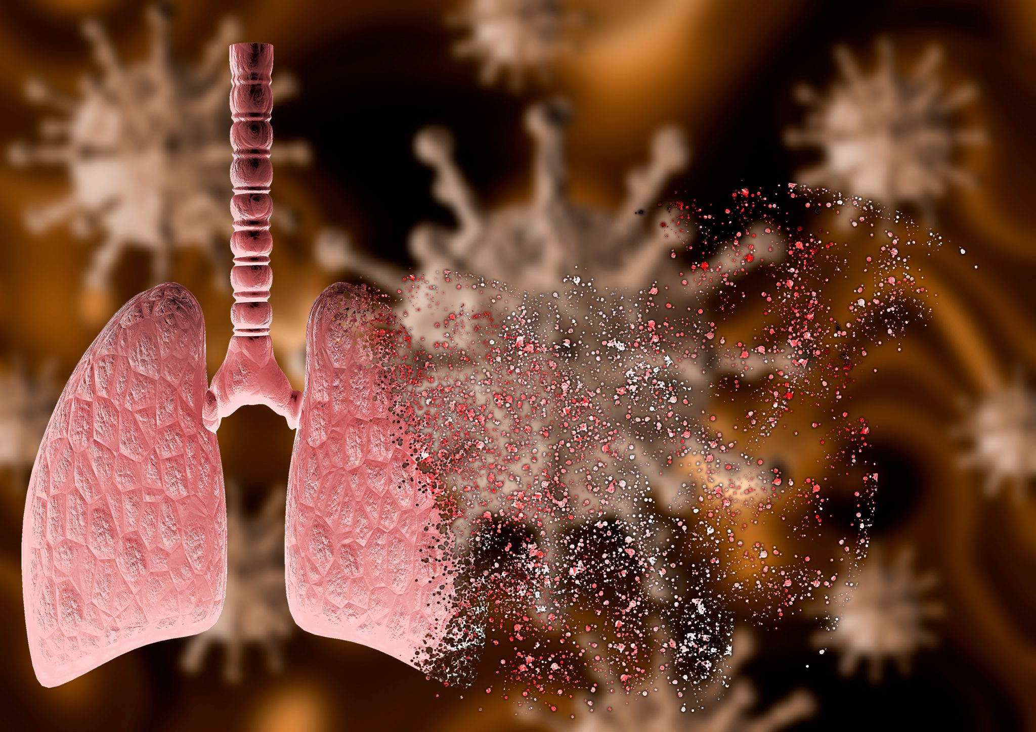 coronavirus attacking lung with severe pneumonia disintegrating it, leading to death